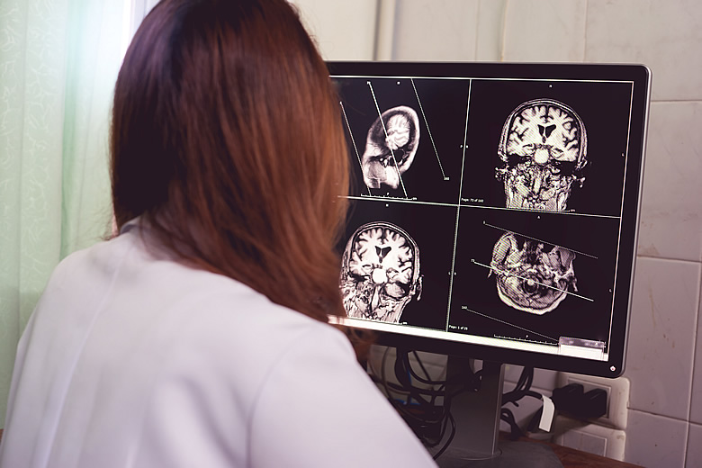 Doctor reviewing brain scans